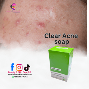 Clear Acne Soap